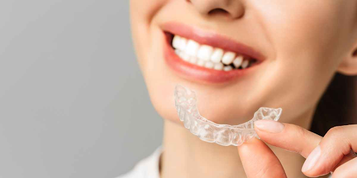 Clear Aligners In Singapore: A Straighter Smile Without The Look of Traditional Braces